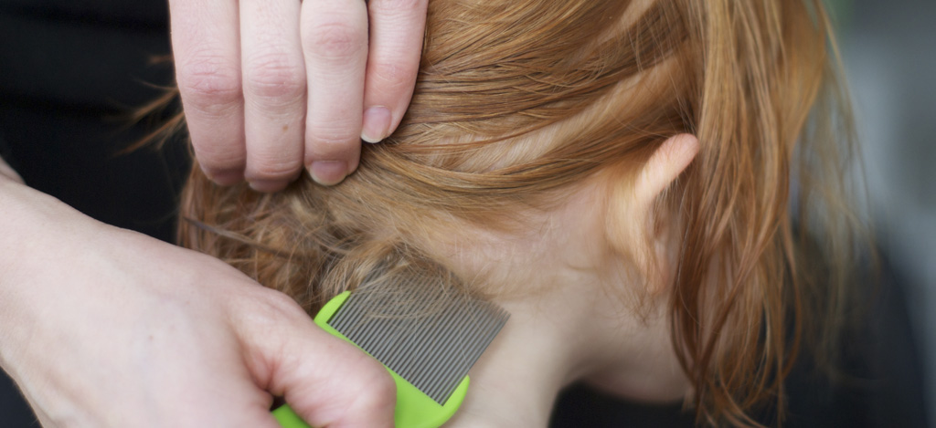 Hodelus lusekam hår